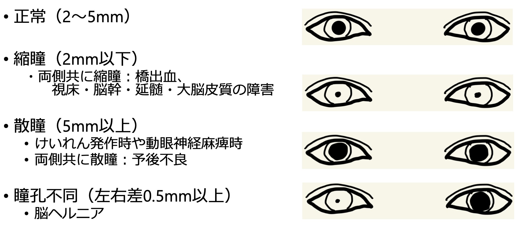 散 瞳 不良